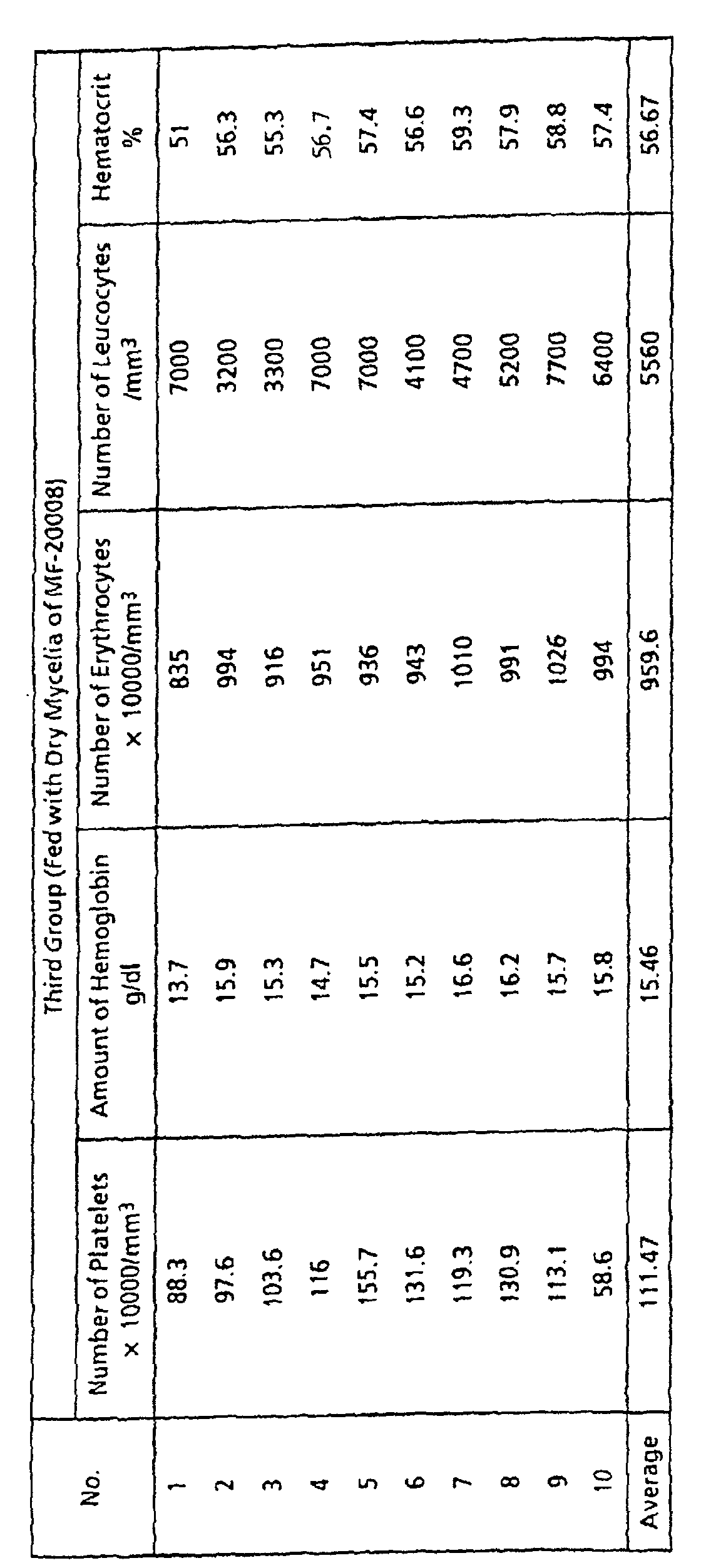 Figure 00160001