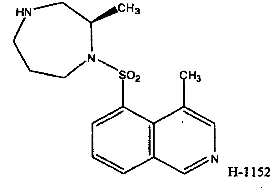 Figure imgb0002