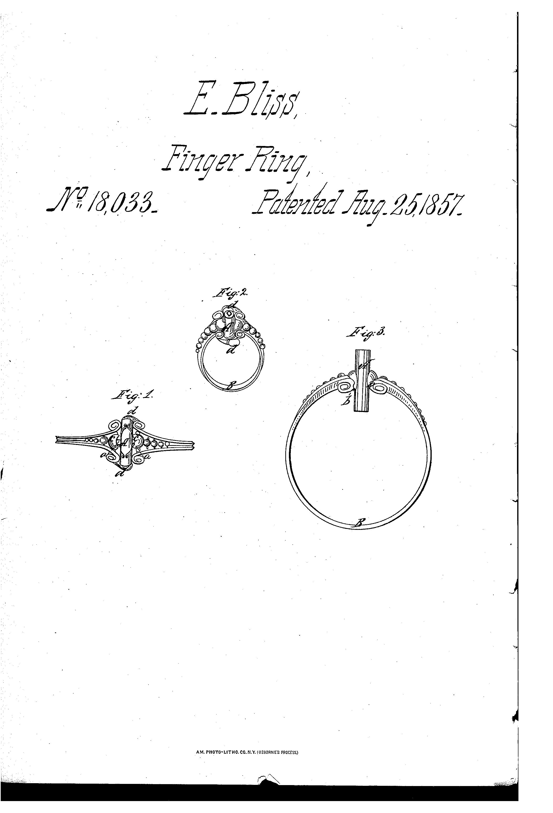 Watch Key With Finger Ring Combine