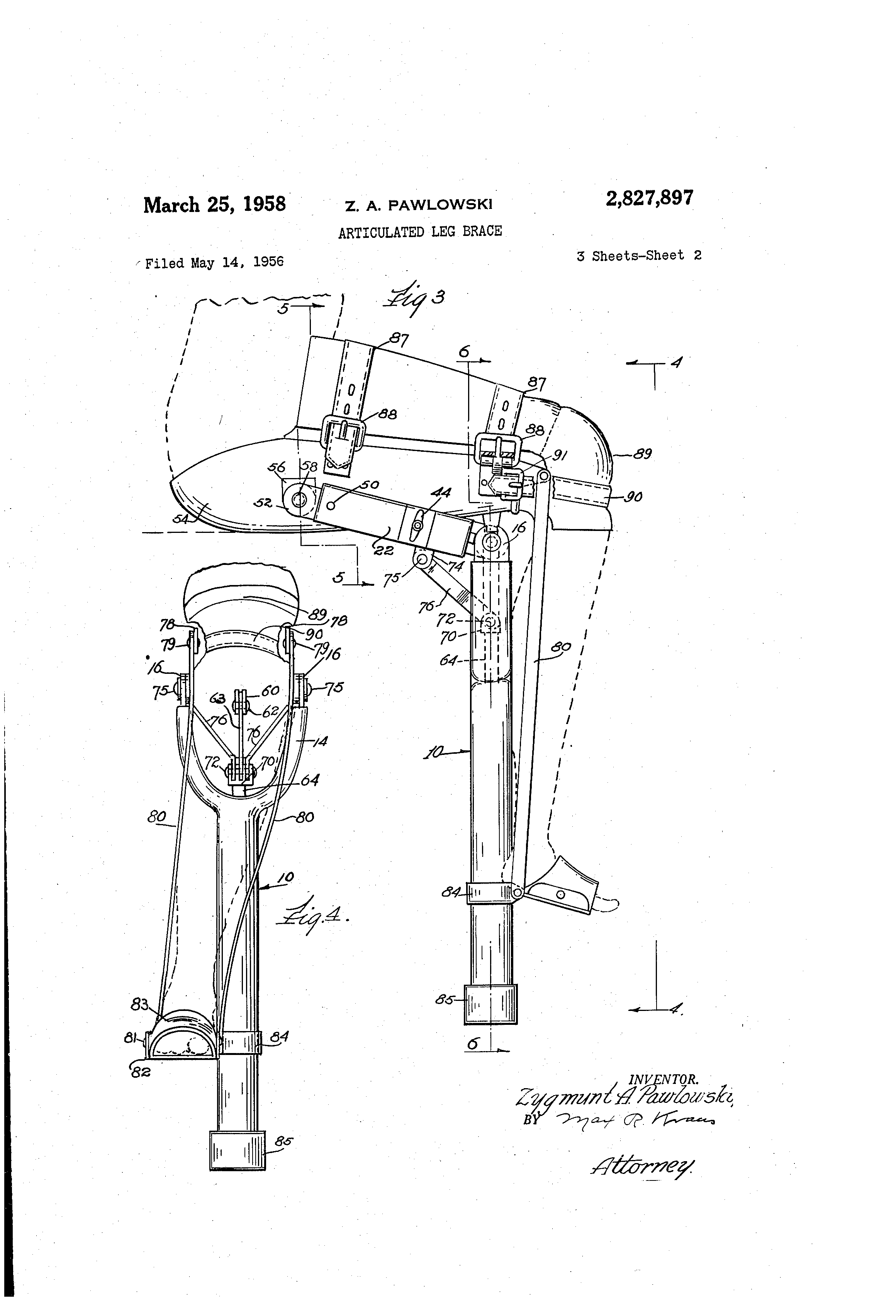 Patent US2827897 Articulated leg brace Google Patents