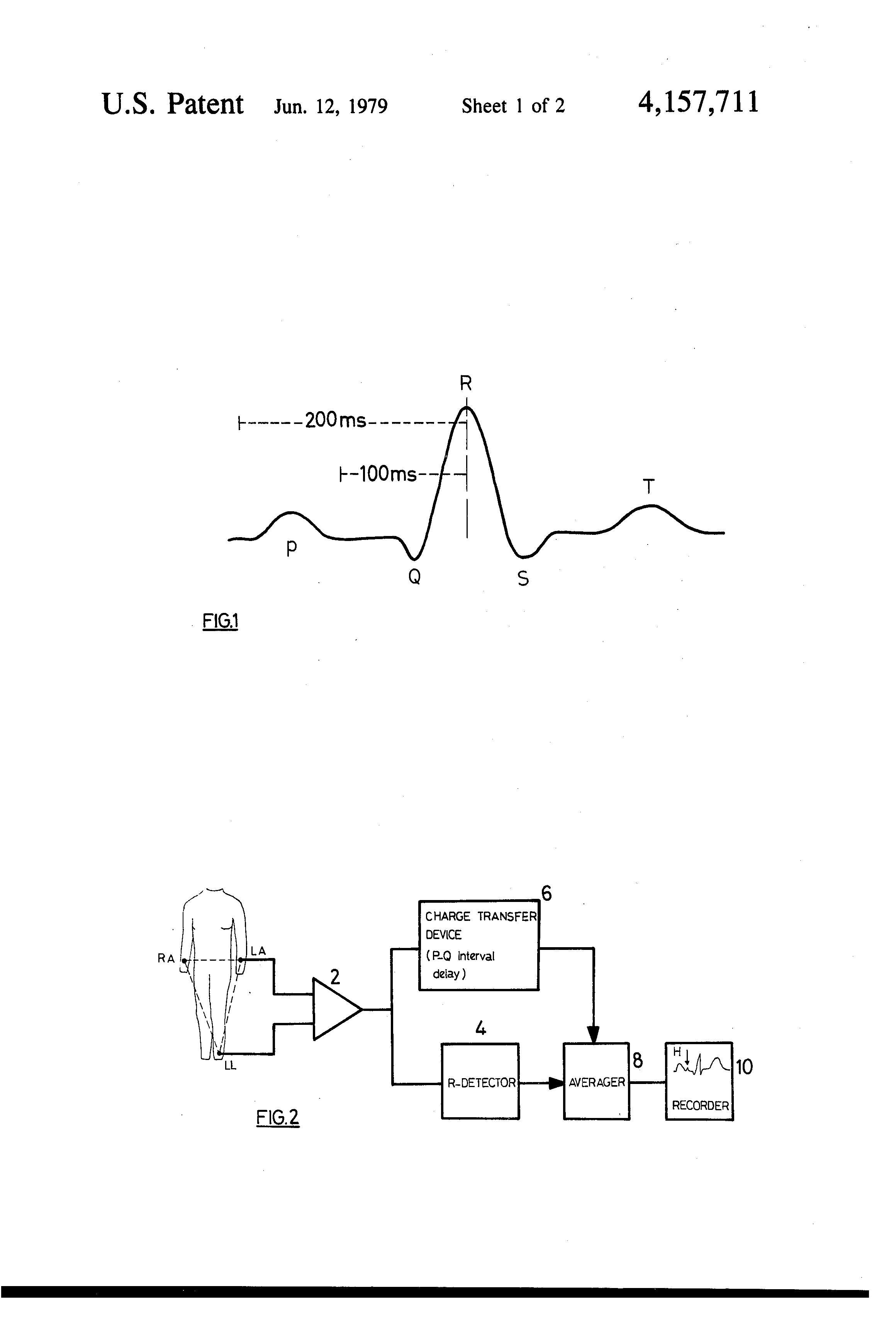 electrocardiograph apparatus capable of discerning th
