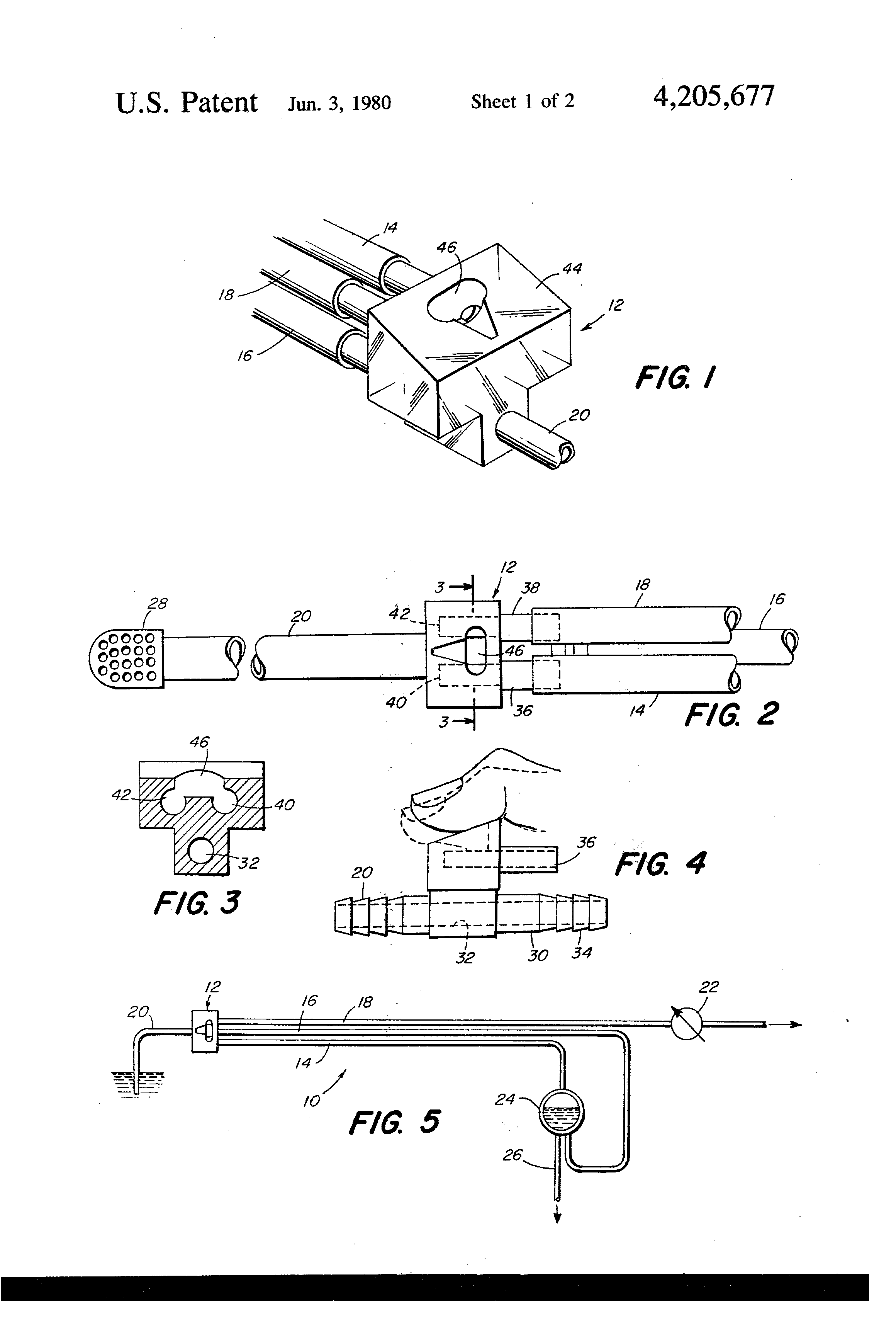 cardiotomy suction control system and valve