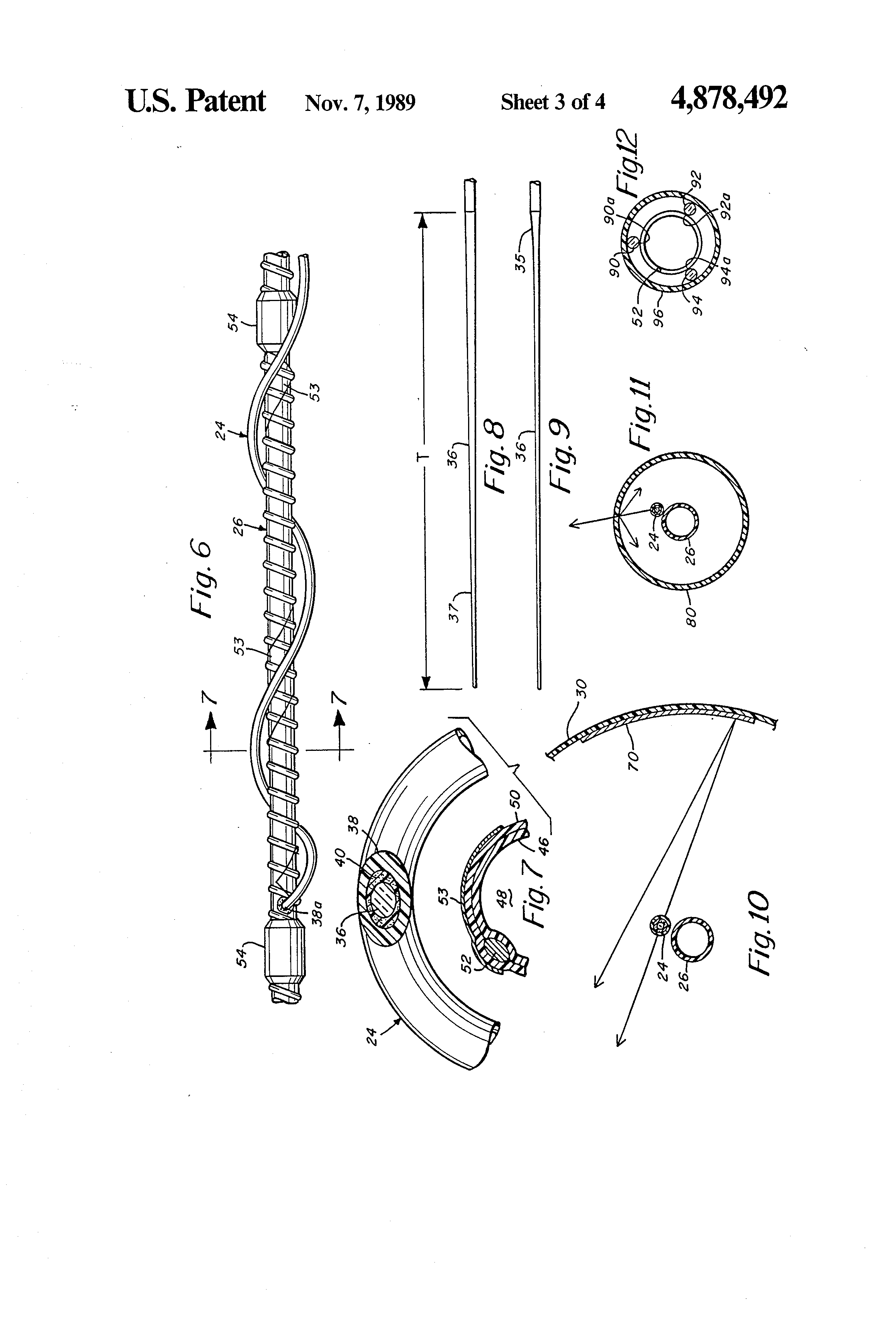 laser balloon catheter