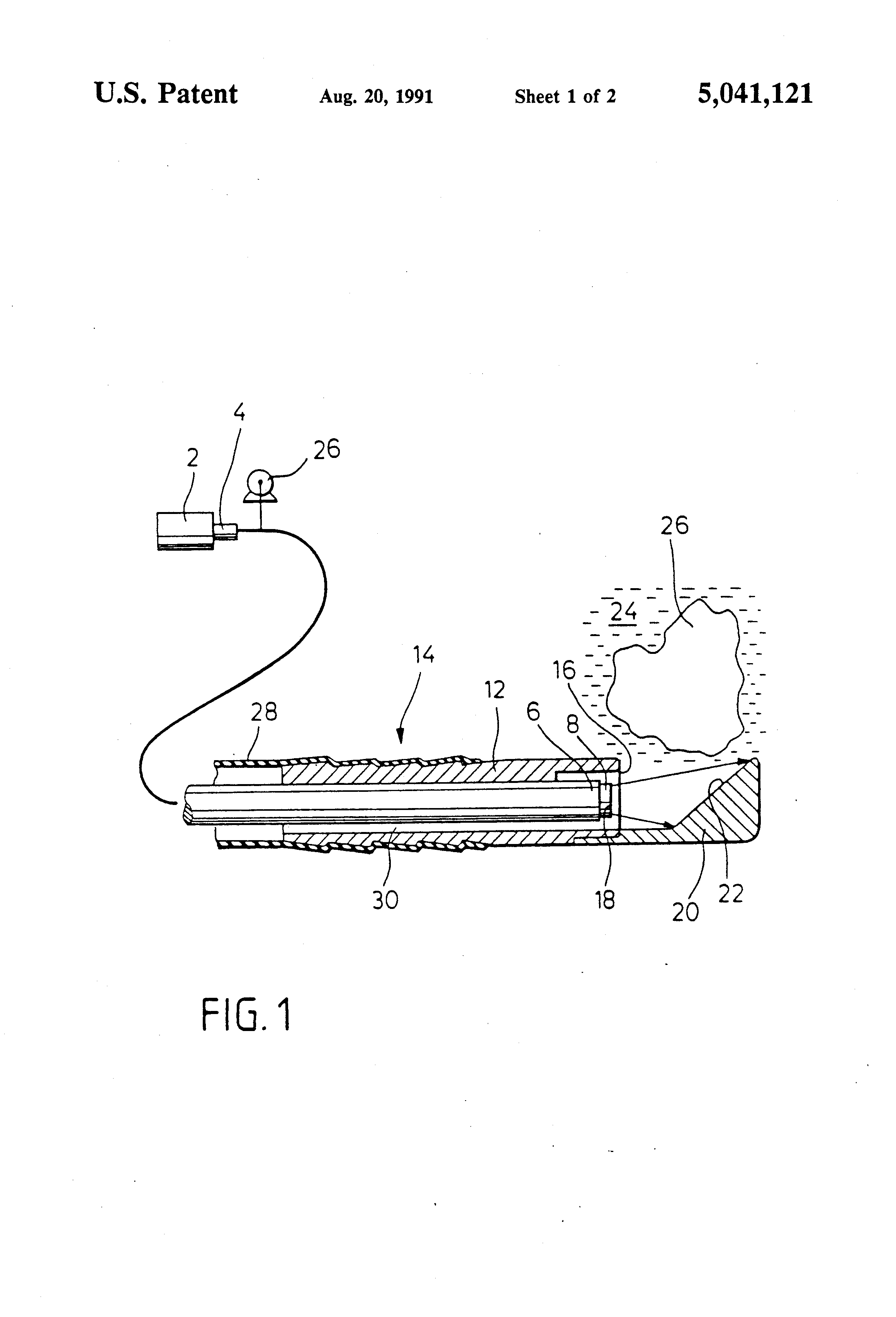 Patent US5041121 Shock Wave Generator Google Patents