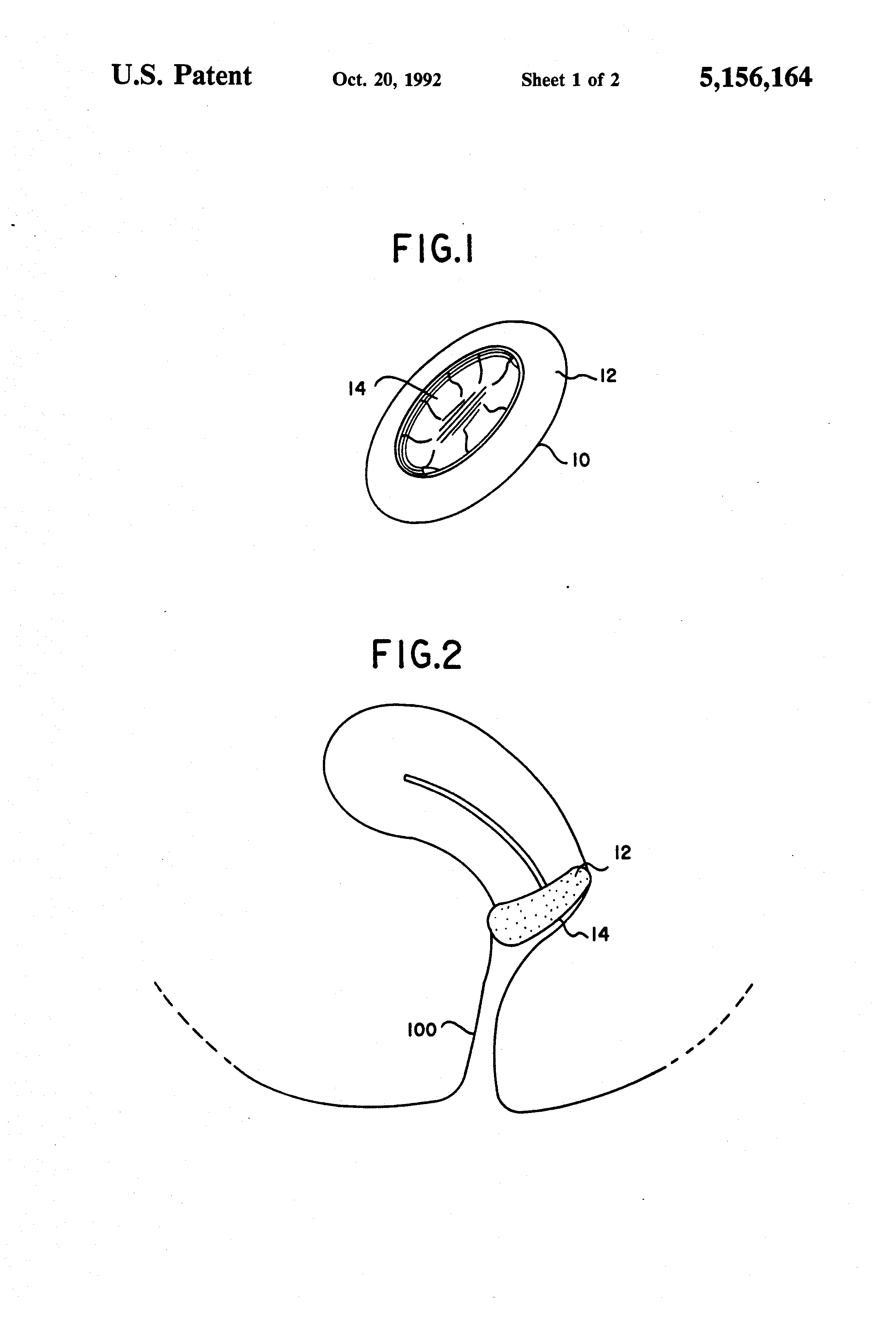 Patent US5156164 Iodine contraceptive sponge Google Patents