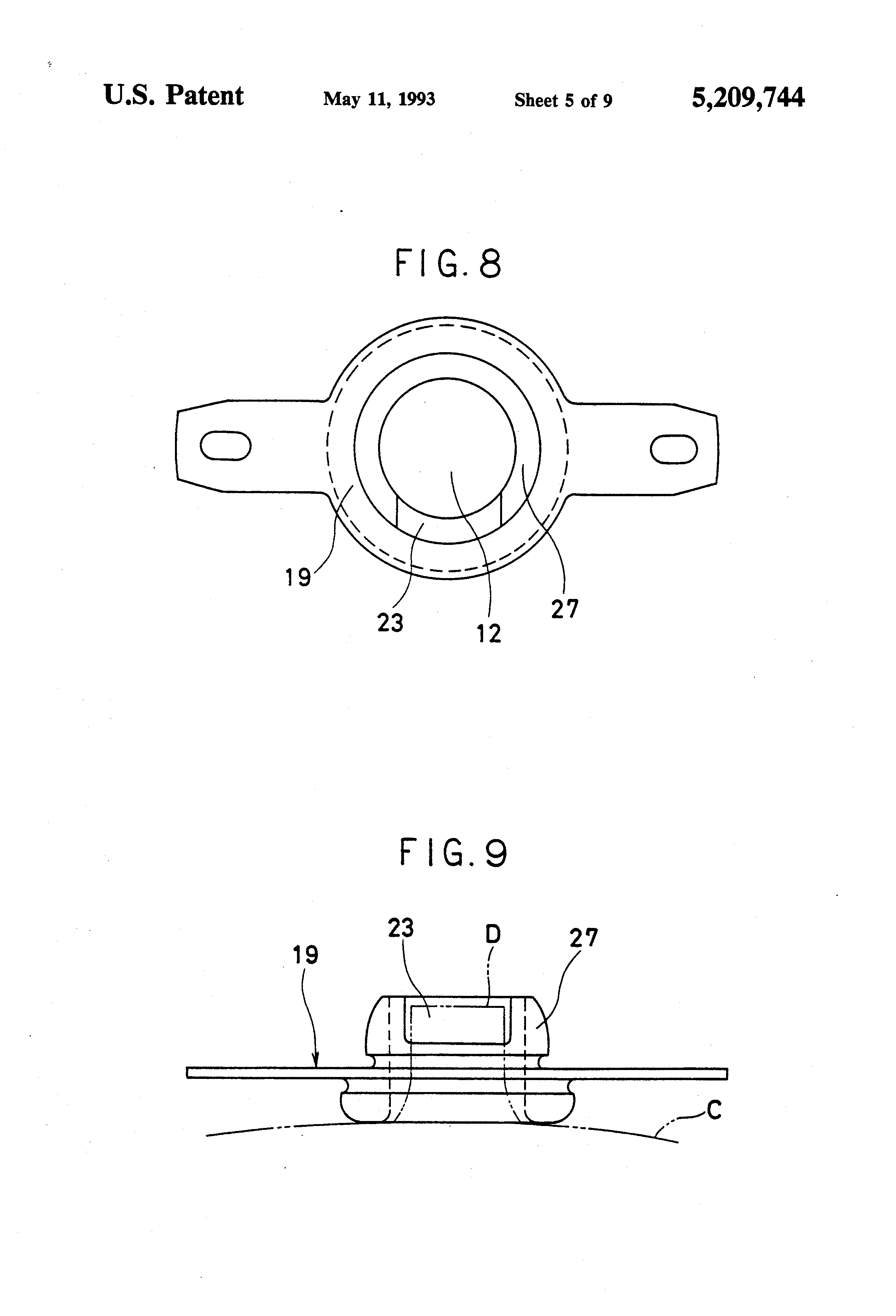 Define patent anus opinion Consider, that Define patent anus maybe