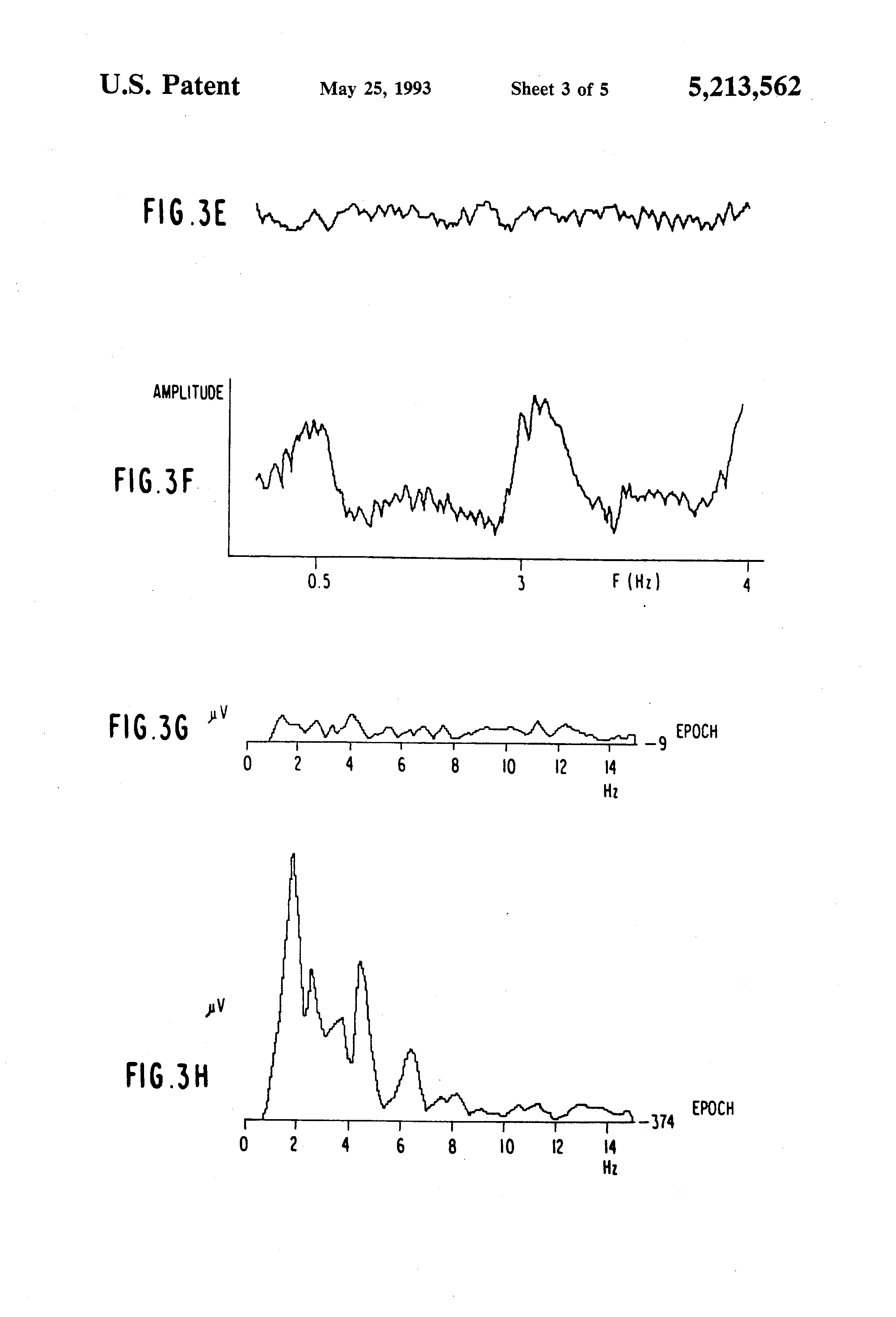 ear and conscious activity Temporary loss of consciousness: a partial or complete loss of consciousness with interruption of awareness of oneself and ones surroundings when the loss of consciousness is temporary and there is spontaneous recovery, it is referred to as syncope or, in nonmedical quarters, fainting syncope. ear and conscious activity Temporary loss of consciousness: a partial or complete loss of consciousness with interruption of awareness of oneself and ones surroundings when the loss of consciousness is temporary and there is spontaneous recovery, it is referred to as syncope or, in nonmedical quarters, fainting syncope.