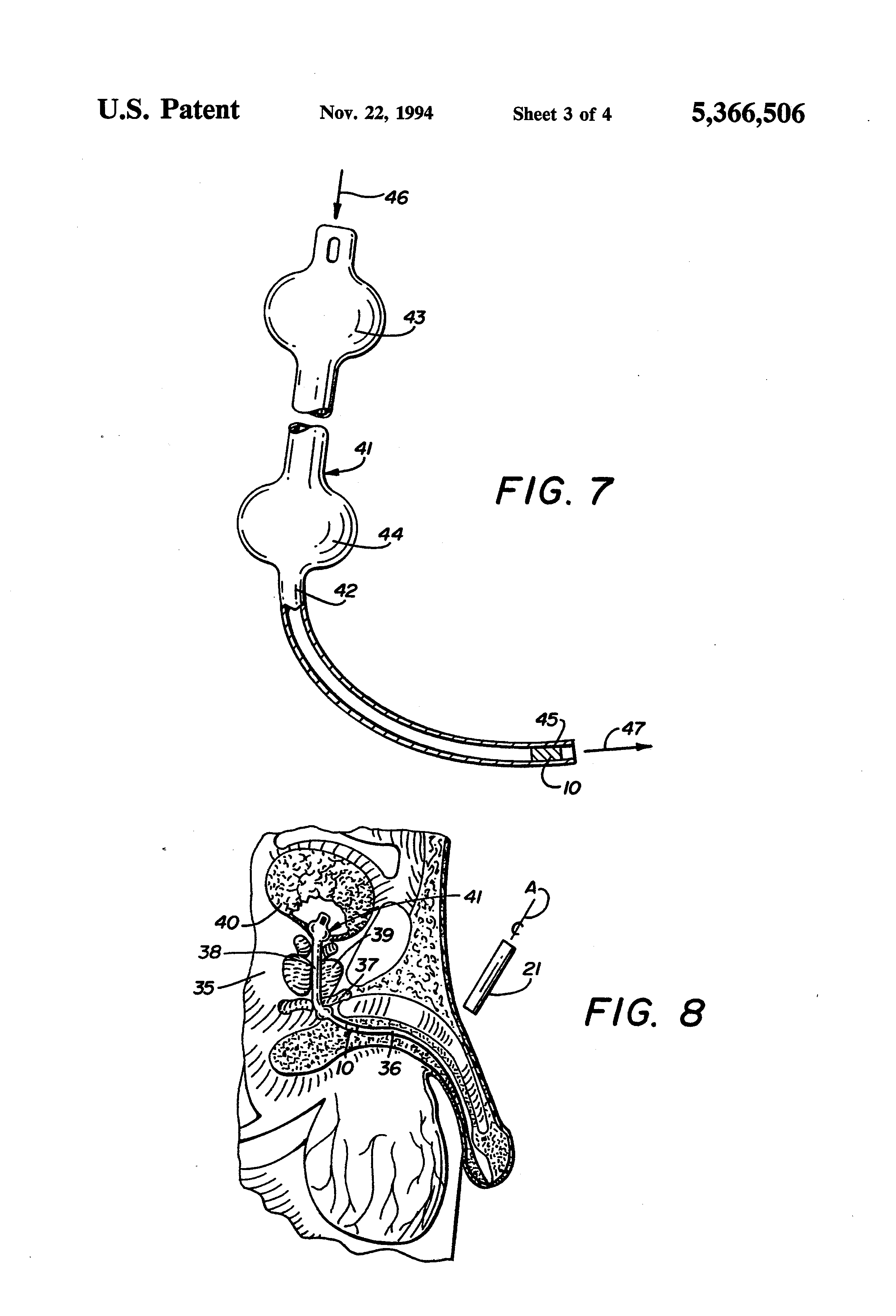 Patent US5366506 Proximity Intraurethral Valve Using Permanent Magnet