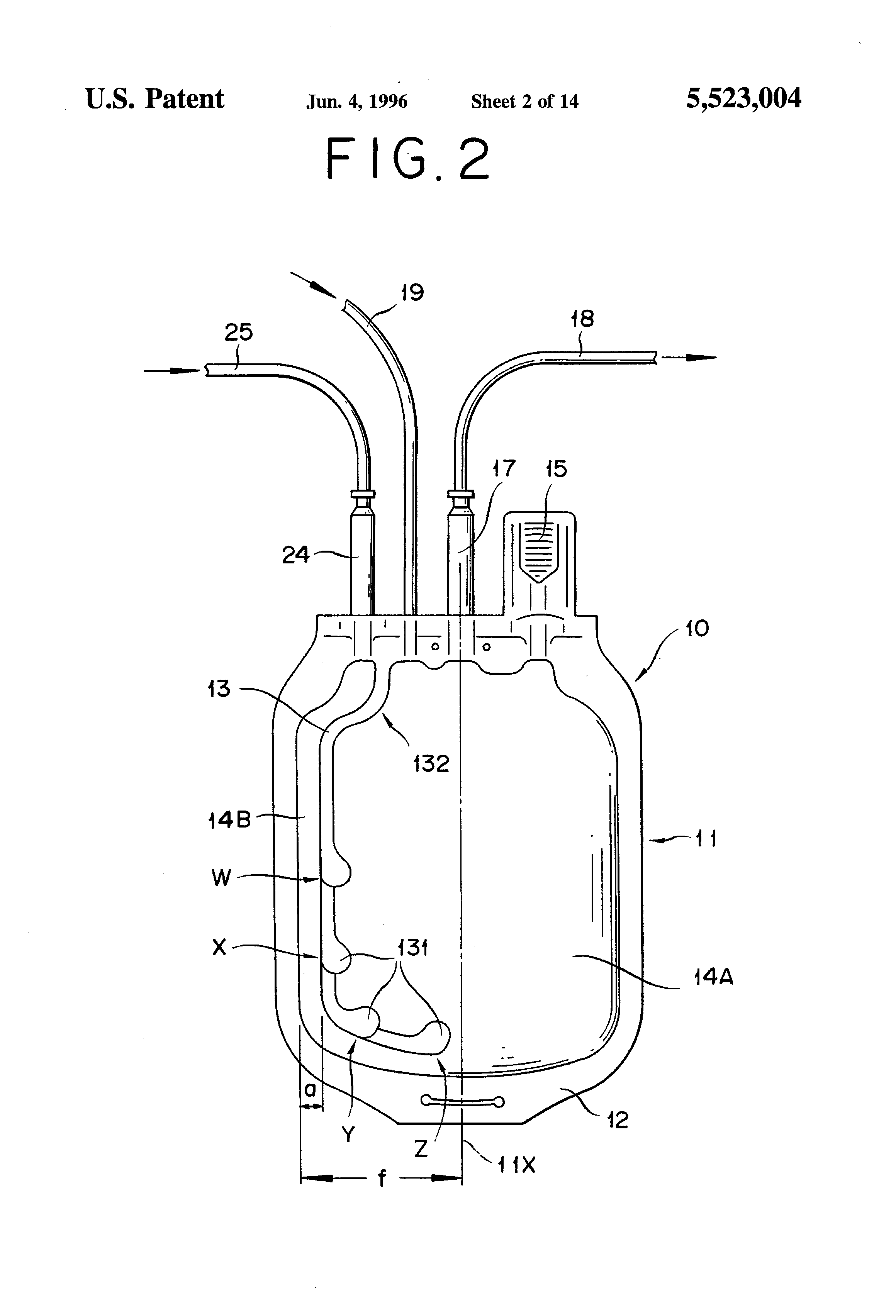 Patent US5523004 Method for treatment of blood using a blood bag