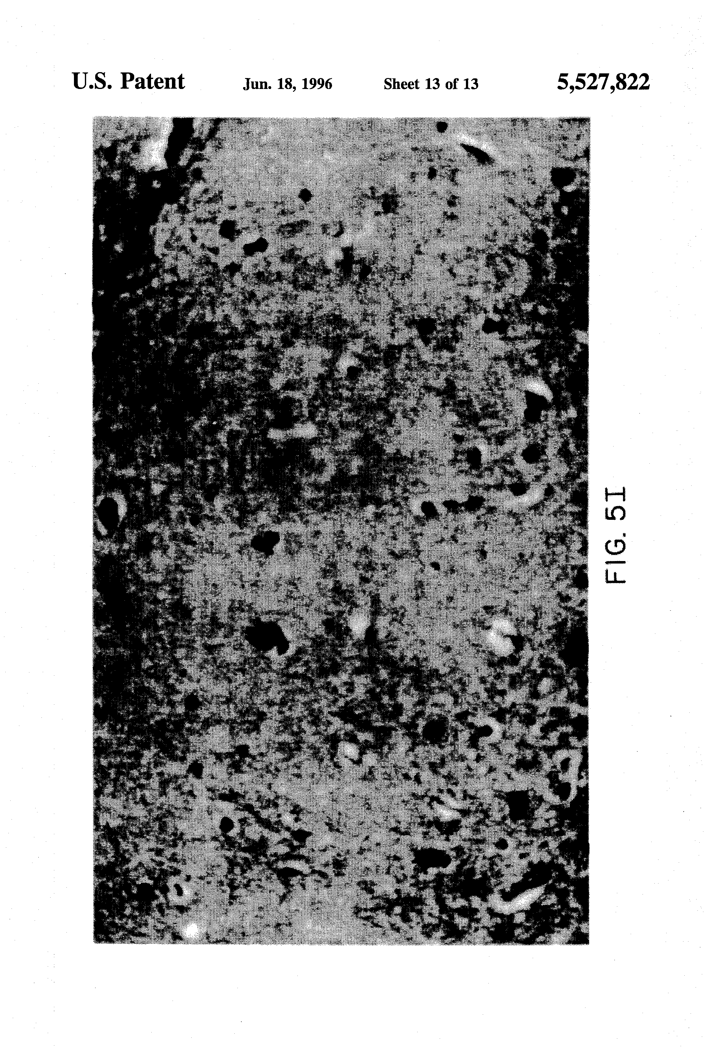 Patent US5527822 Method Of Treatment Of Traumatic Brain Injury