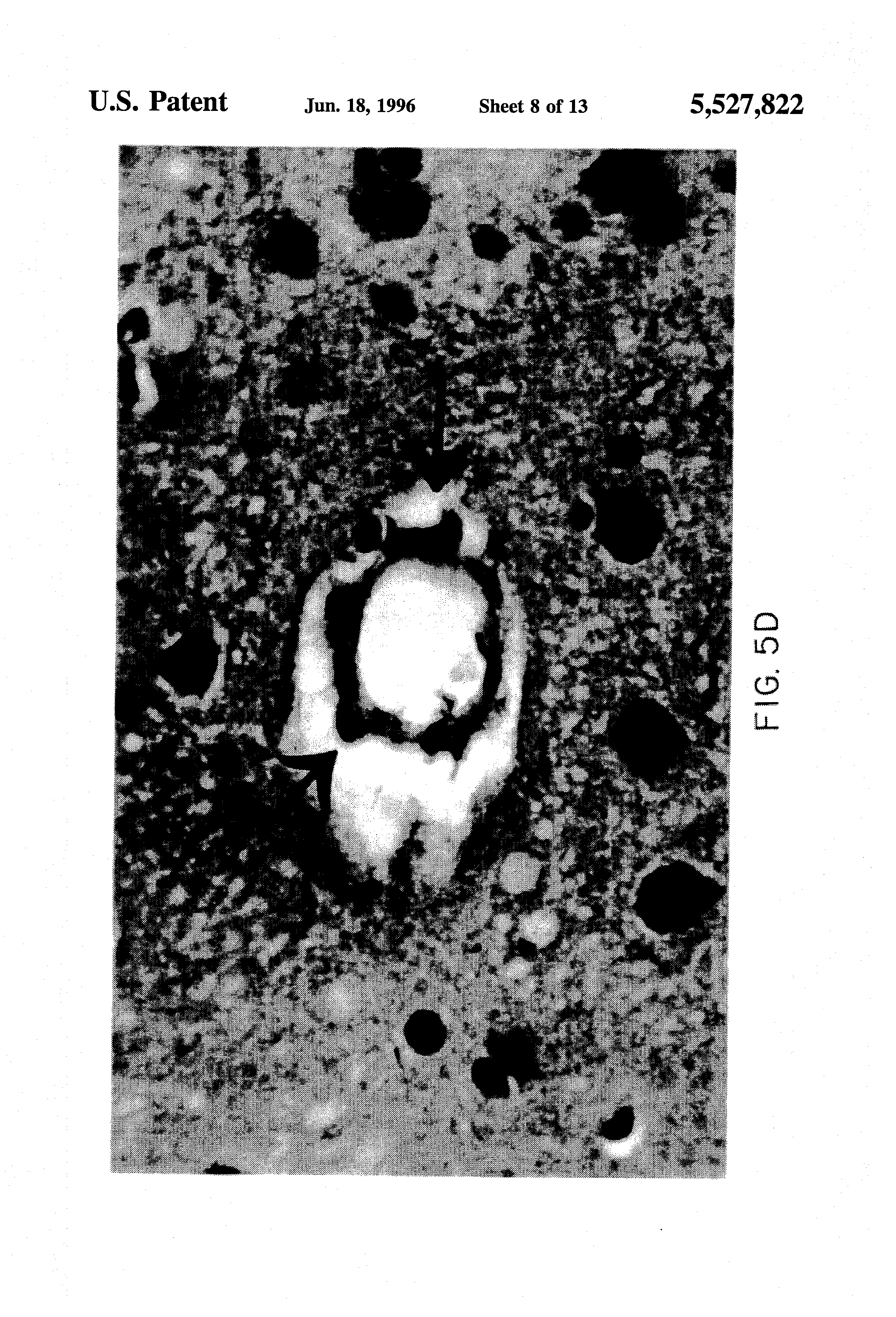Patent US5527822 Method Of Treatment Of Traumatic Brain Injury