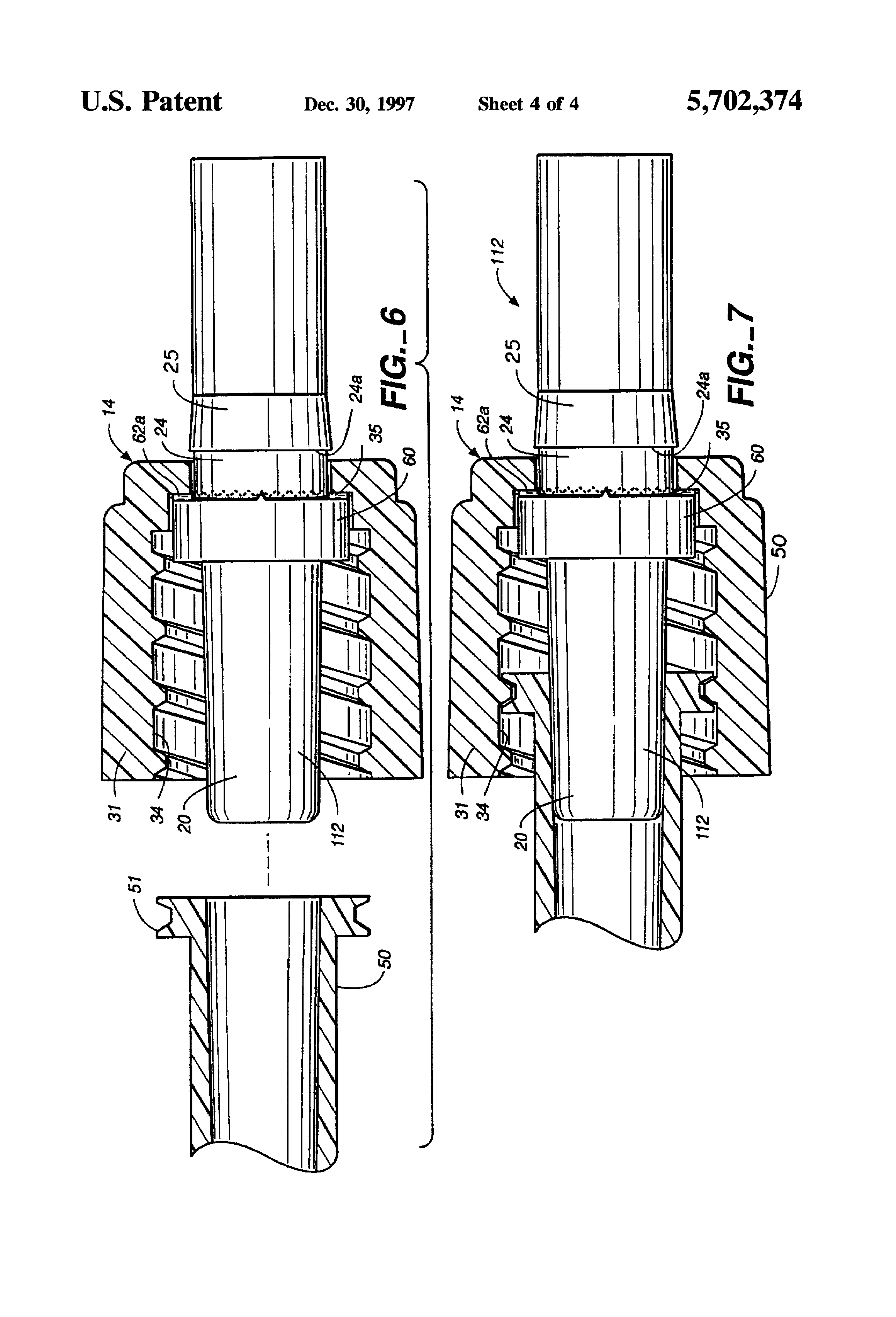 Disposable Female Luer Luer-Lock syringes