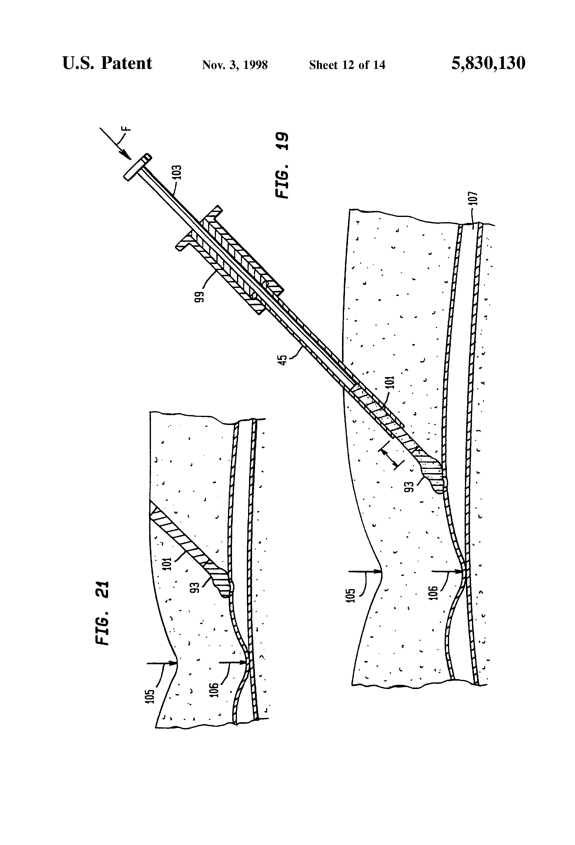 device and method for sealing puncture wounds