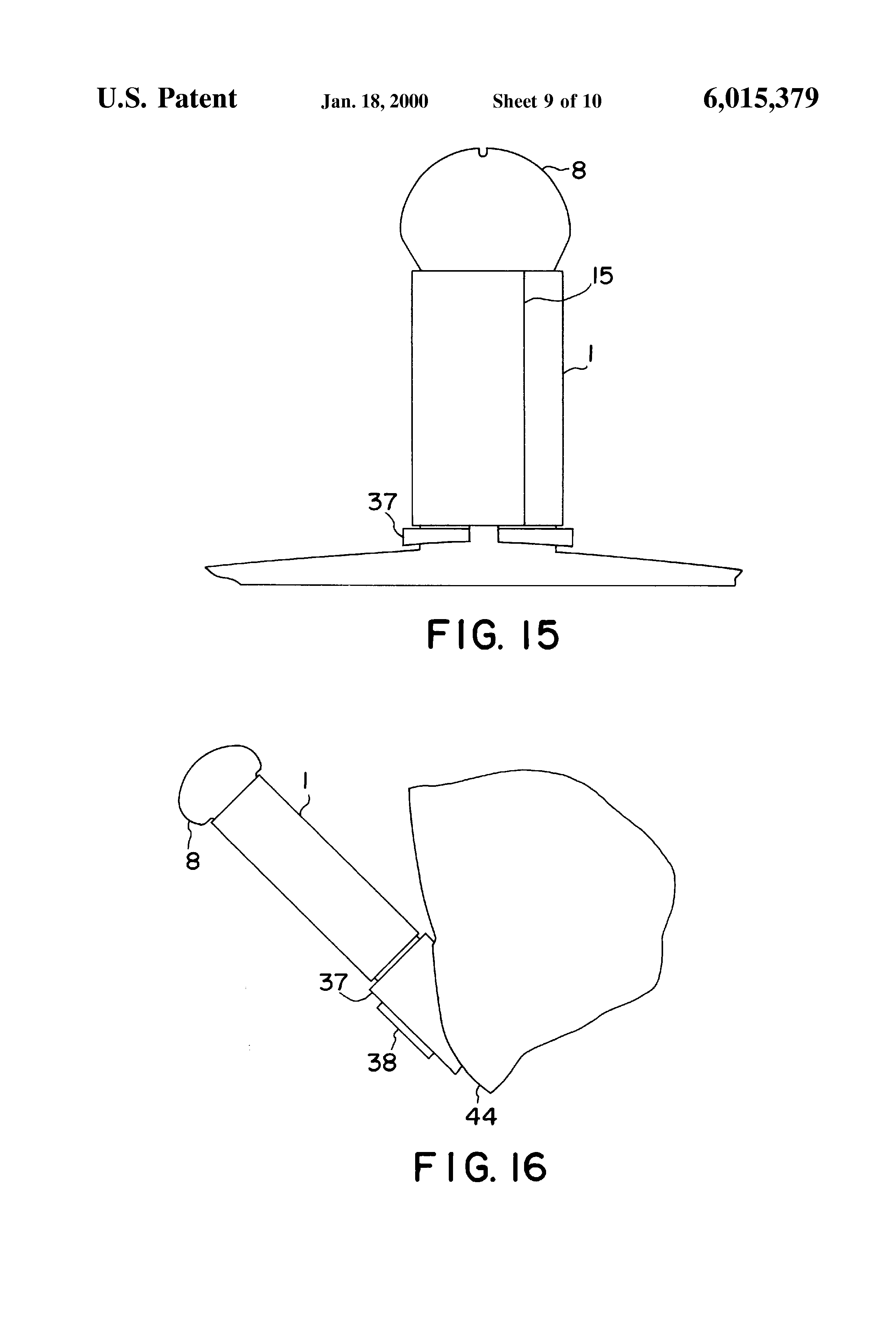 male implant how does a penile implant work