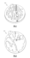 Adressable matrices/cluster blanks for dental CAD/CAM systems and ...
